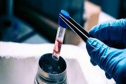 روش جدید نگهداری اعضای اهدایی بدن