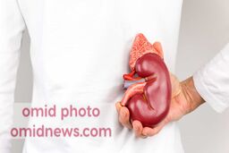 سنگ کلیه و چگونگی مبارزه با آن