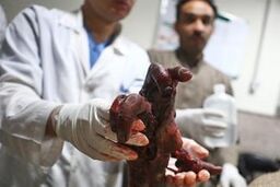 دختربچه ۸ ساله اولین قربانی چهارشنبه آخر سال تهران
