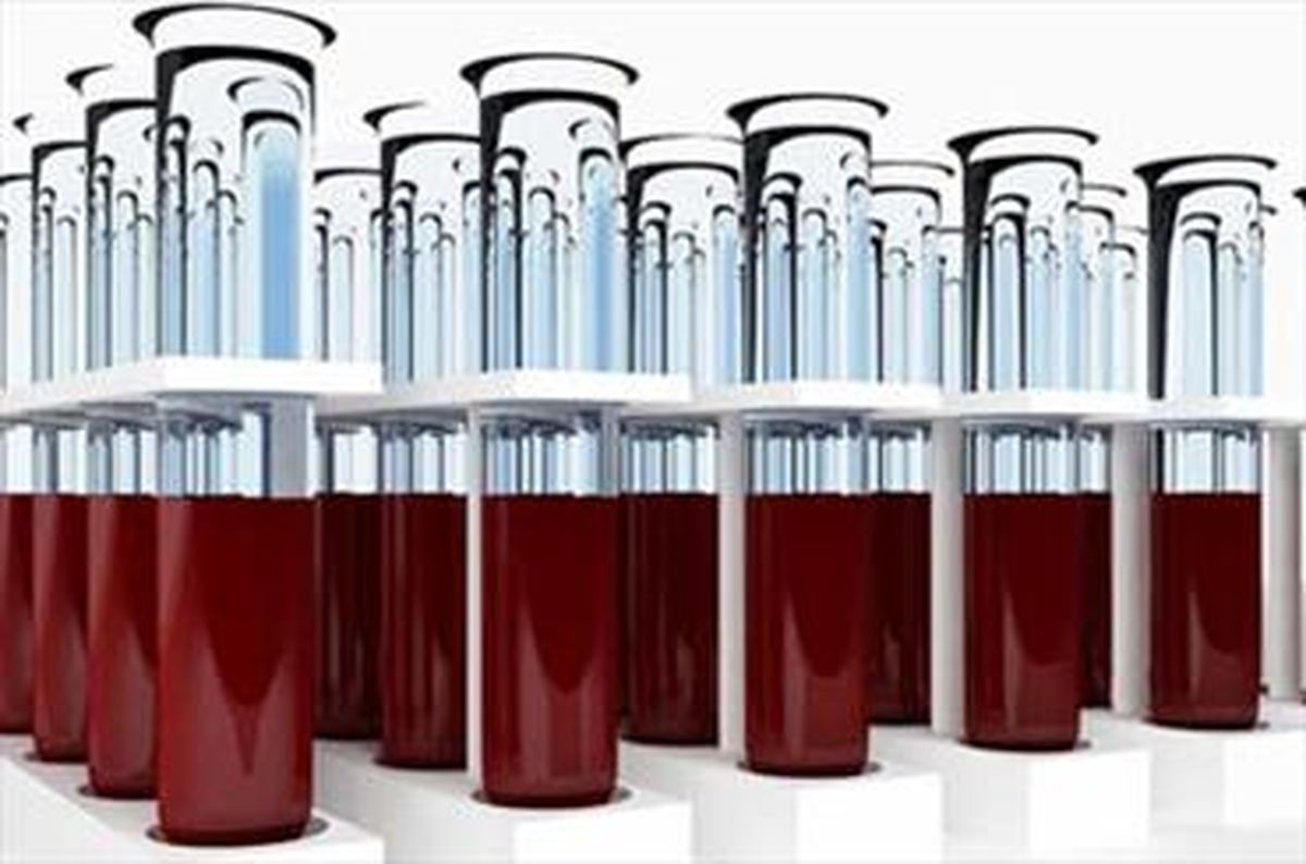 یوفا از بازیکنان آزمایش خون می‌گیرد