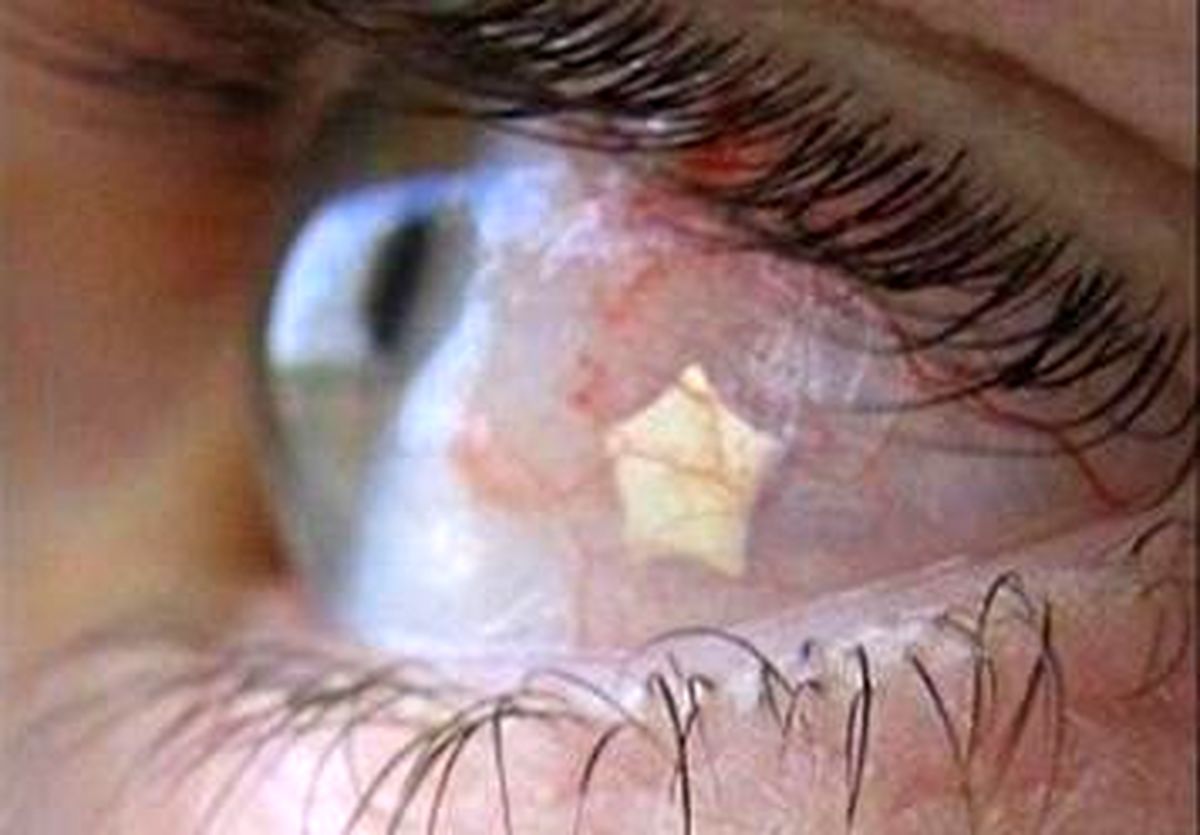 نگین های ممنوع اروپایی سنگفرش چشمان ایرانی