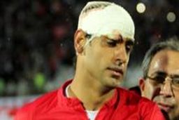 مصدومیت طالبی برطرف شد / تراکتورسازی بدون مصدوم مقابل استقلال خوزستان