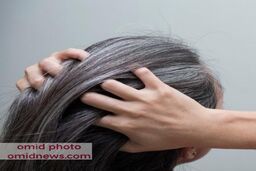 ویتامین هایی که به سیاهی مو کمک میکند