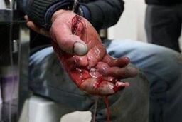دانش آموزان مواد محترقه را در داخل جیب خود حمل نکنند