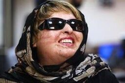 آمنه بهرامی همچنان پیگیر معالجات و شکایت مجدد از مرد اسیدپاش