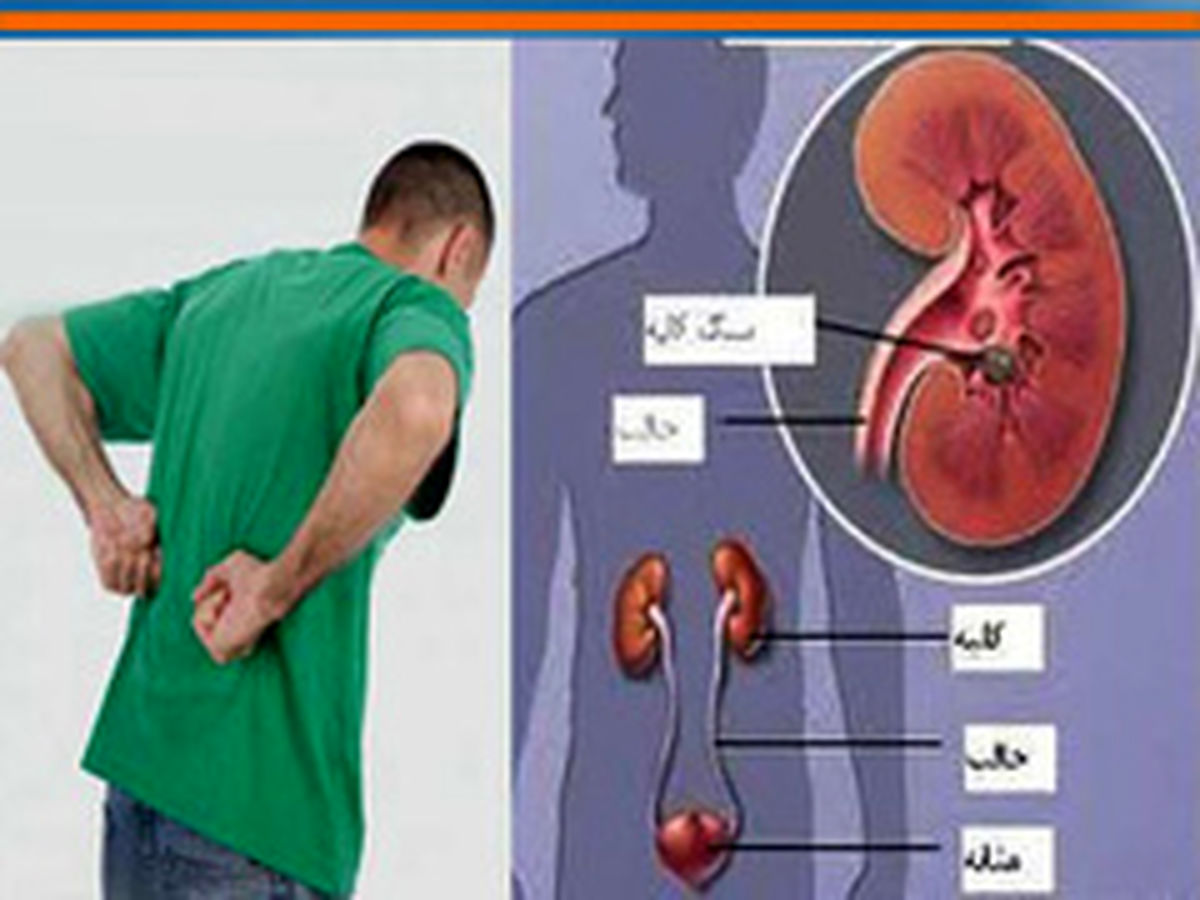 دیابت شایعترین علت نارسایی مزمن کلیه