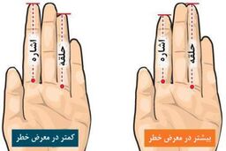 مطالعه طول انگشتان دست برای بررسی خطر ابتلا به سرطان پروستات
