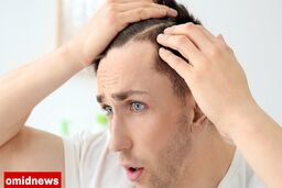 موثرترین روش برای از بین بردن سفیدی موهایتان