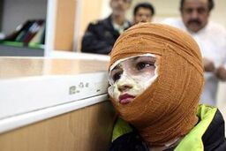 ۴ مجروح چهارشنبه پایان سال به بیمارستان منتقل شدند