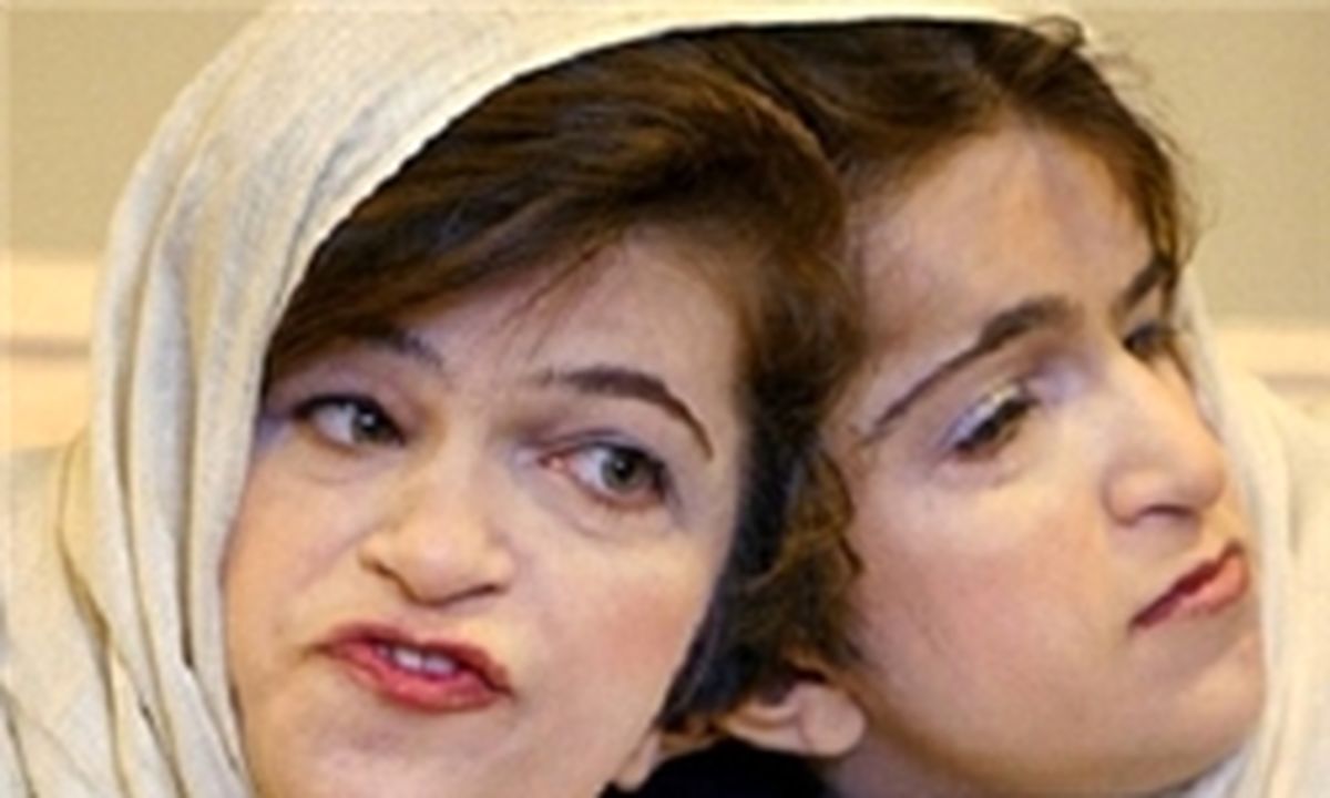 ناگفته‌های مسئول تشریح جسد لاله و لادن