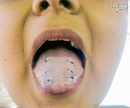 عجیبترین رژیمهای لاغری که تا به حال گرفته شده اند